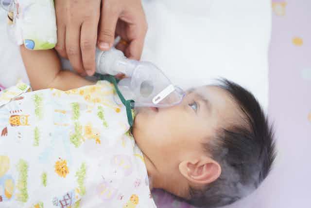 Baby being treated for respiratory issue