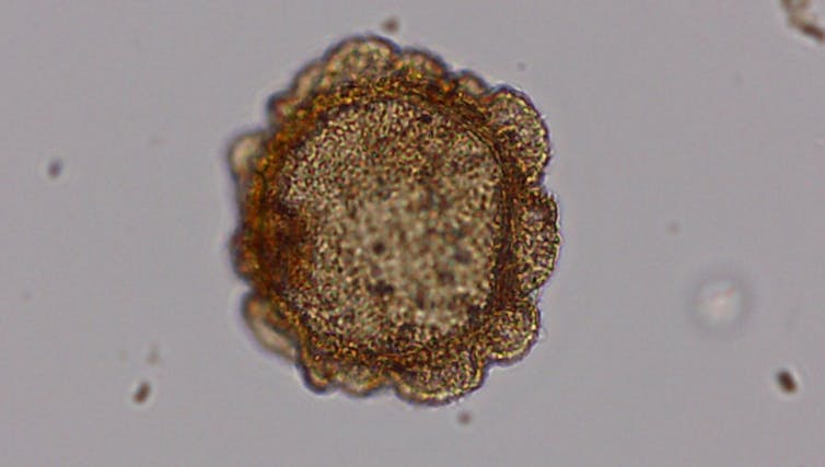 Microscopic pollen