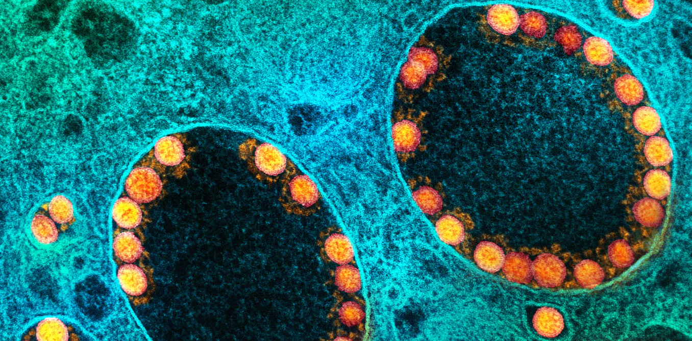 How new COVID-19 variants emerge: Natural selection and the evolution ...