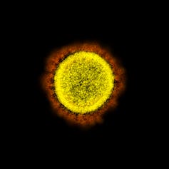 A yellow coronavirus with red spikes against a black background