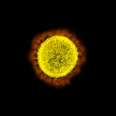 A yellow coronavirus with red spikes against a black background