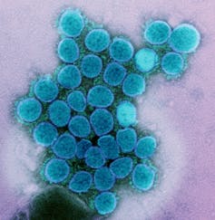 Cluster of blue coronaviruses against a lavender background