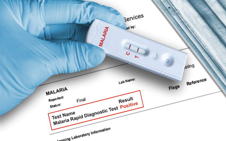 Rapid diagnostic testing device held by hand in medical glove 