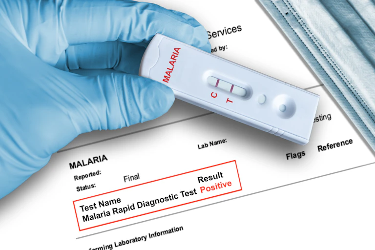 Rapid diagnostic testing device held by hand in medical glove