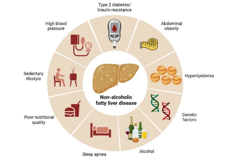 Uncovering the genetic causes of fatty liver disease — a growing health  concern