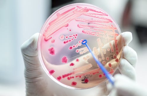 'Host-directed therapy' could treat infectious diseases – including COVID – and limit drug-resistance