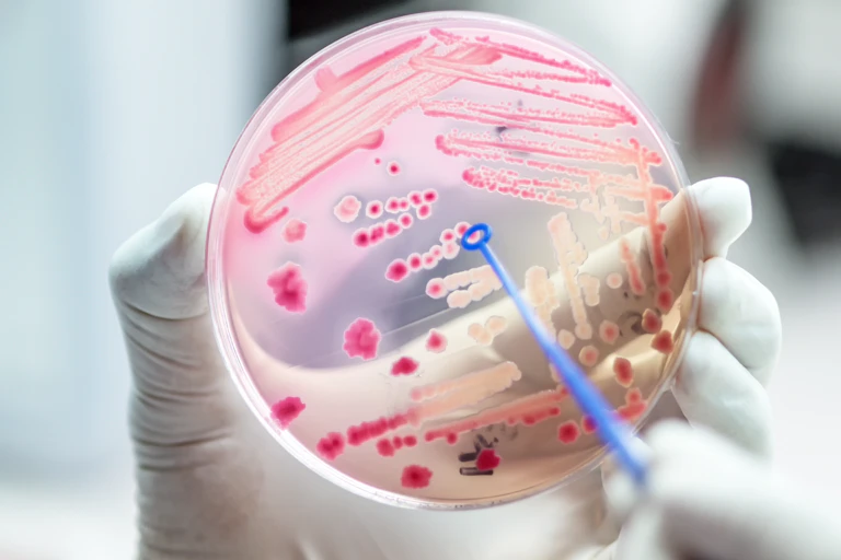 cell growth in petri dish