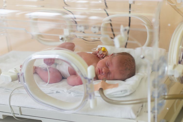 A baby in neonatal intensive care