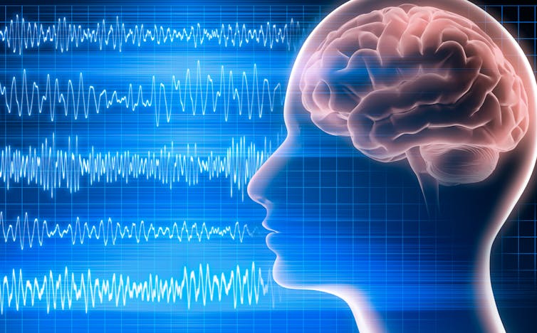Illustration of brain waves as measured by EEG