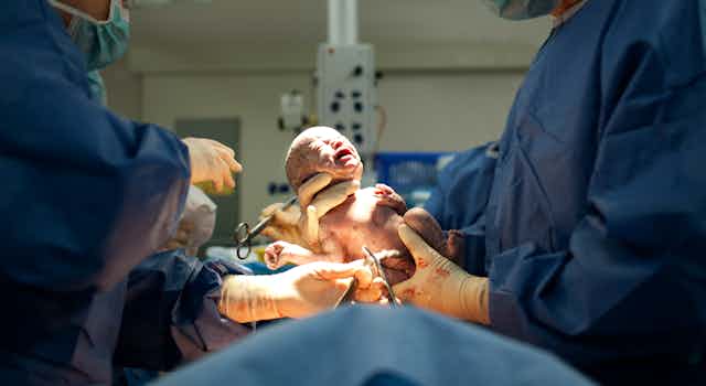 baby is born in surgical setting