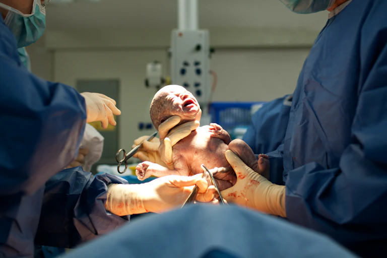 baby is born in surgical setting