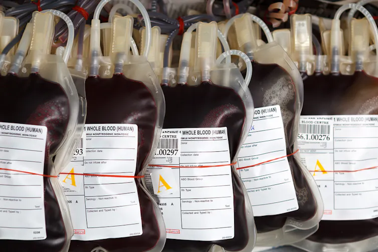 Bags of type A blood