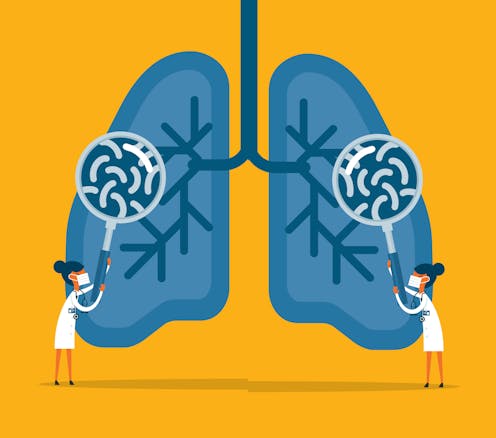 Lungs have their own microbiome – and these microbes affect the success of bone marrow transplants in kids