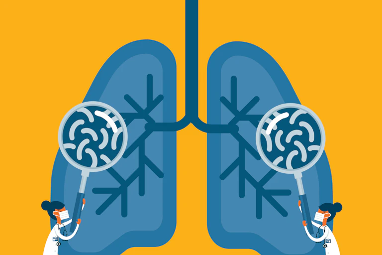 Illustration of two health care providers holding up magnifying glasses to a pair of blue lungs, revealing the presence of bacteria