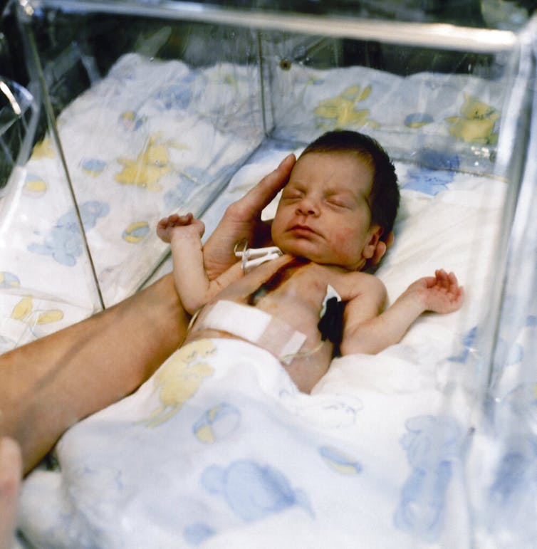 An infant lies in incubator, with her head cradled in an adult's hand.