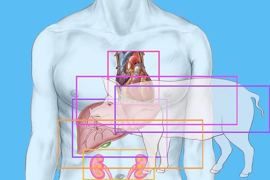 Illustration showing a person's torso with their heart, liver, and kidneys outlined in colored rectangles, with a pig superimposed on top.