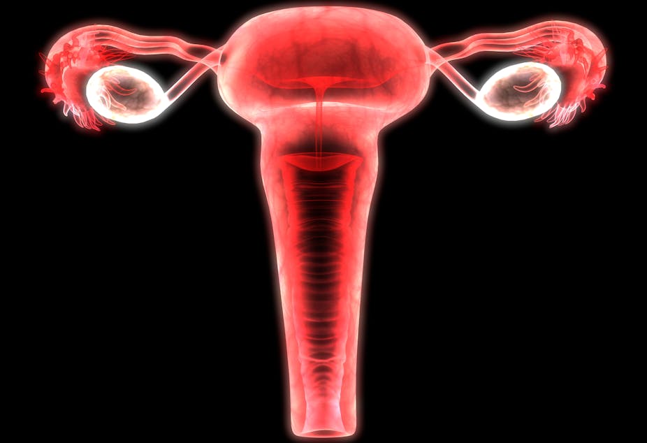 Against a black background is a computer's 3D red and white rendering of a vagina, uterus, ovaries and fallopian tubes.