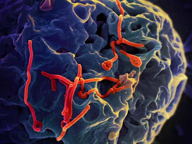 Red Ebola virus particles budding from the surface of a blue kidney cell.