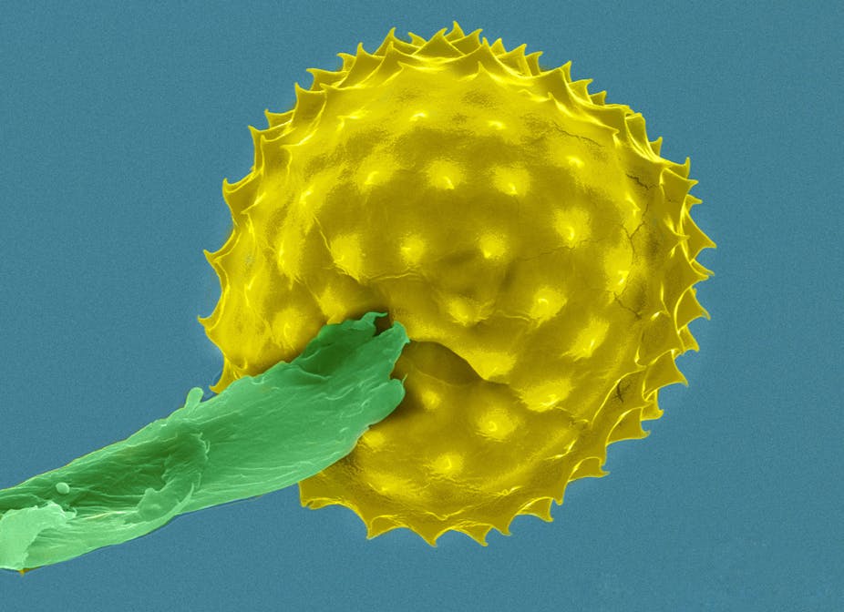 A colorized, highly magnified ragweed pollen grain. It's round with rows of pointy spikes all around.