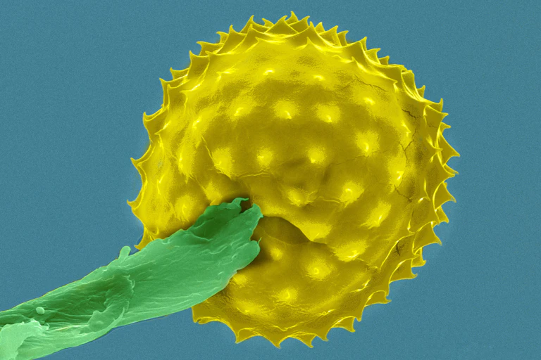 A colorized, highly magnified ragweed pollen grain. It's round with rows of pointy spikes all around.
