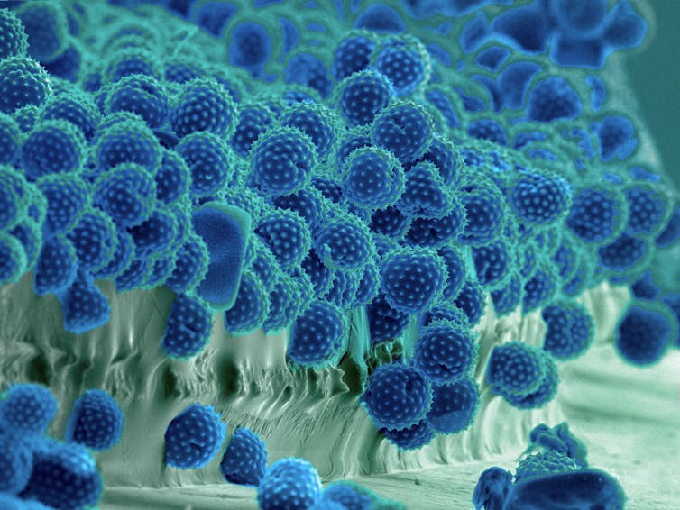 Dozens of round spiky pollen grains attached to a plant