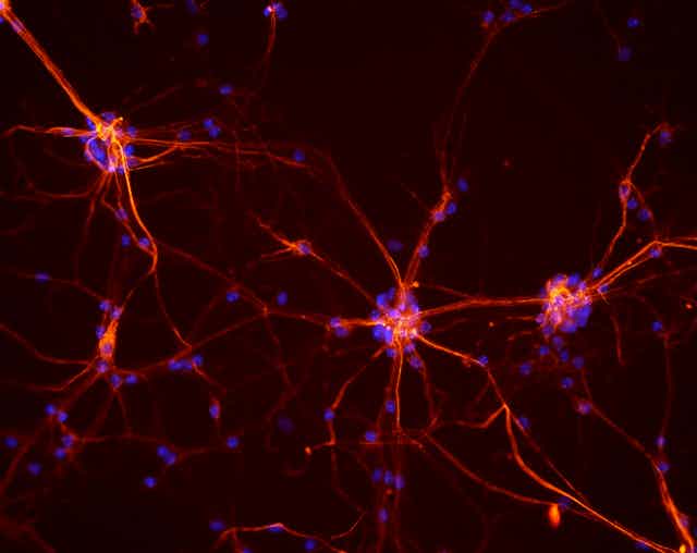 Réseaux de neurones :3 cellules pourvues de nombreuses excroissances connectées entre elles