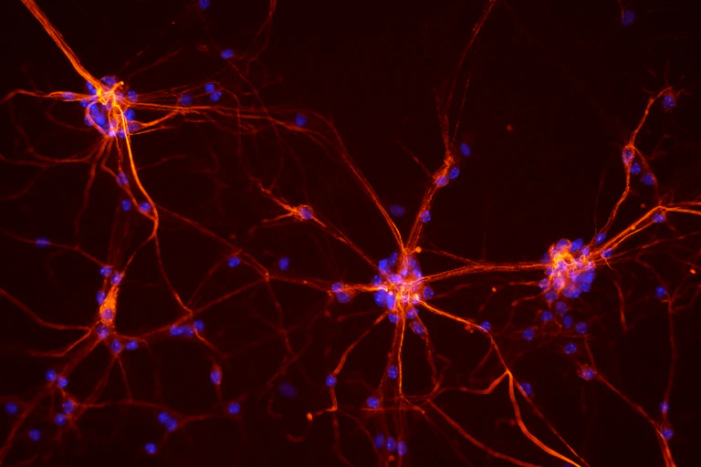 Réseaux de neurones :3 cellules pourvues de nombreuses excroissances connectées entre elles