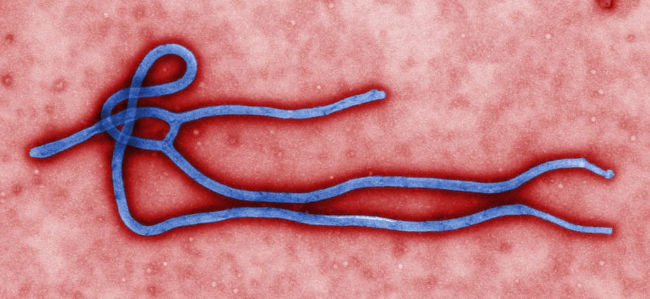 Image result for ebola virus