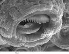 Detalle da mandíbula dunha paralarva de polbo, baixo o microscopio electrónico, autor I. Molto e A. Lancha. Author provided