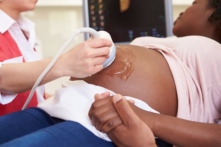 Woman looks at a screen while having an ultrasound.