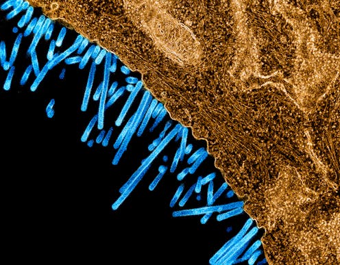 La gripe contraataca con una segunda epidemia La gripe contraataca con una segunda epidemia