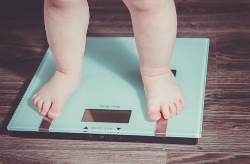 Síndrome de Prader-Willi: una enfermedad rara que convierte la comida en obsesión Síndrome de Prader-Willi: una enfermedad rara que convierte la comida en obsesión
