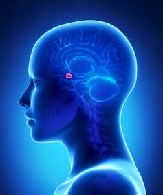 Illustration of a female head in profile, showing brain anatomy with the amygdala in red