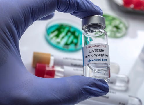 La bacteria que contamina el queso no pasteurizado y la carne mechada sigue sin vacuna La bacteria que contamina el queso no pasteurizado y la carne mechada sigue sin vacuna