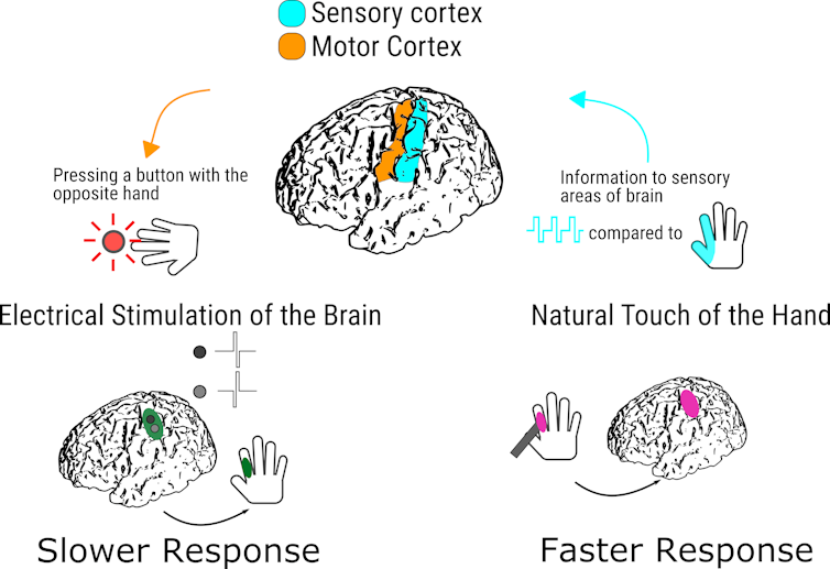 Line drawing illustrates slower response time to direct electrical stimulation of the brain