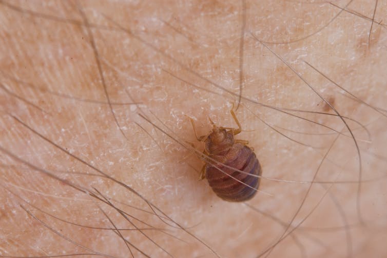 Insecte brun sur le bras d’un homme, en train de se nourrir