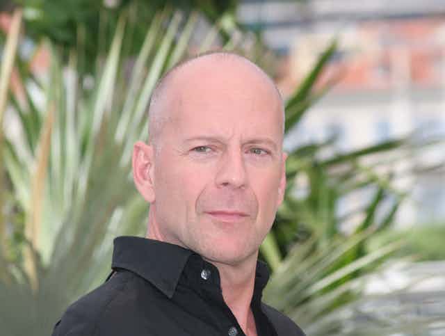 A bald man in a black shirt with greenery in the background