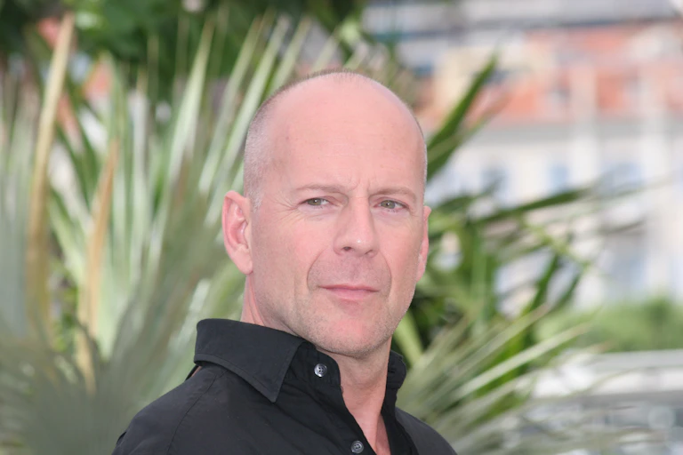 A bald man in a black shirt with greenery in the background