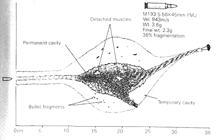 A diagram/sketch shows the wound profile of a bullet and the damage done by military rifles.