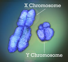 Schéma des deux chromosomes X et Y. X est plus grand avec quatre bras bien dessinés (en forme de X, en somme). Y est plus petit, avec des bras dissymétriques