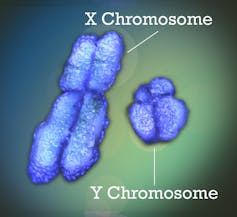 Diagram of the X and Y chromosomes. X is larger, with four well-defined arms (X-shaped, in short). Y is smaller, with asymmetrical arms.