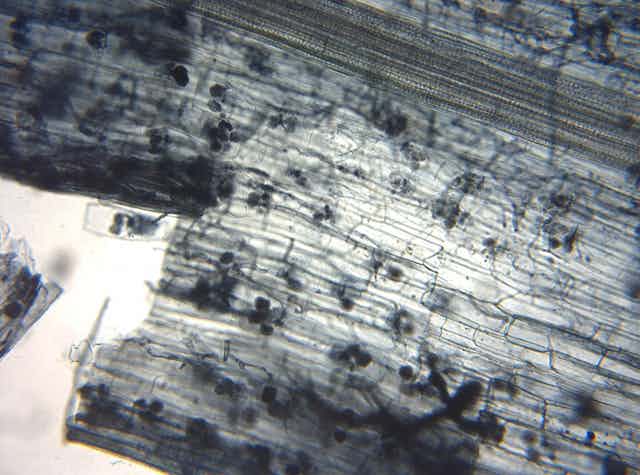 Hongos ectomicorrícico visto al microscopio