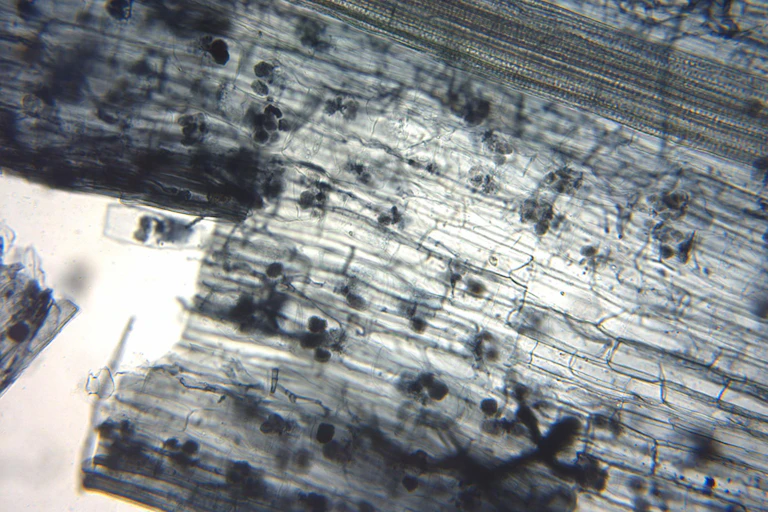 Hongos ectomicorrícico visto al microscopio