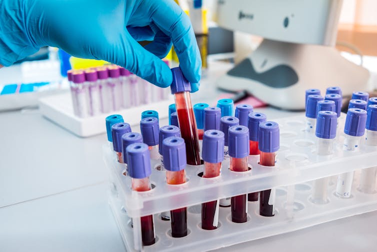 A gloved hand placing a vial of blood into a rack on a laboratory bench filled with other vials of blood.