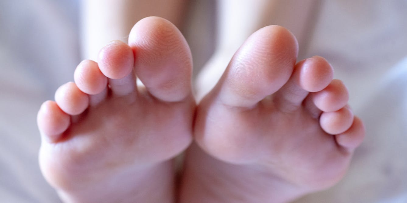 What is toe jam? From harmless gunk to a feast for bugs