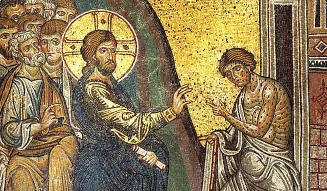 Mosaic shows Jesus with a halo reaching out to touch a diseased man.