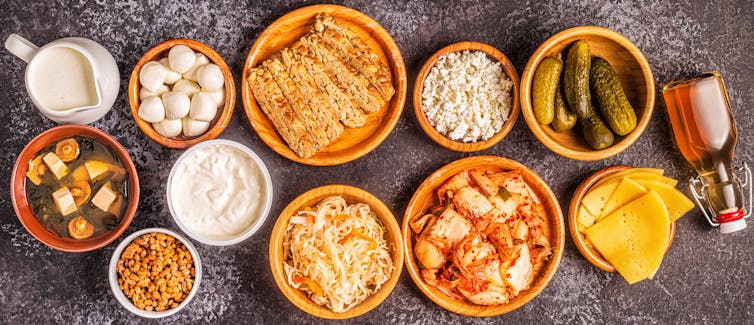 An array of fermented foods shot from above.