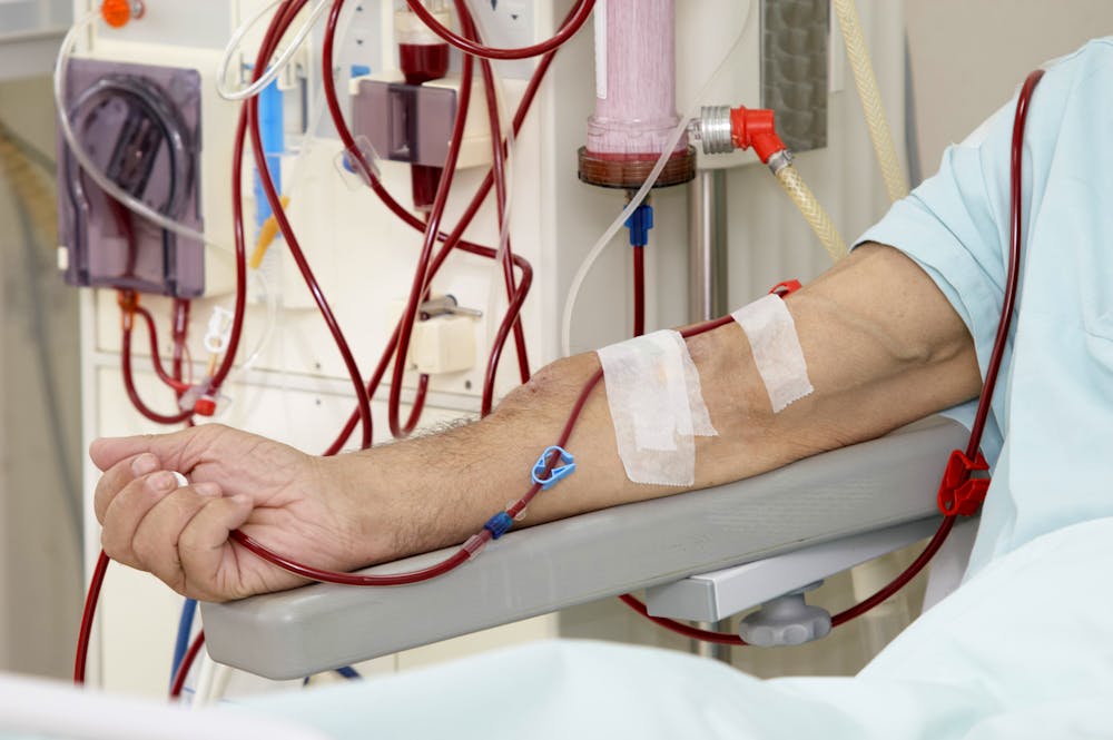 hemodialysis-new-research-could-vastly-improve-this-life-sustaining