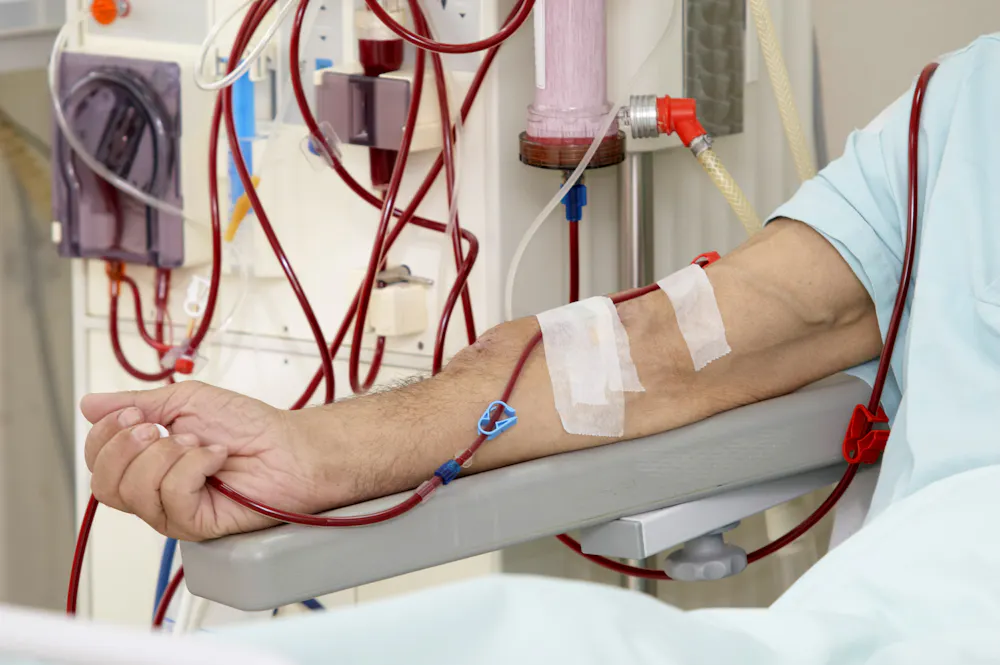 Dialysis Program Hemodialysis: New research could vastly improve this life-sustaining ...