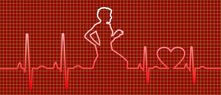 Illustration of an EKG heartbeat readout incorporating a figure running and a heart